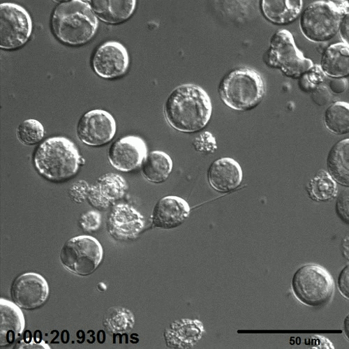 crystals growing inside cell